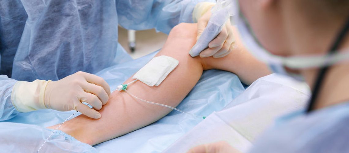 Crioescleroterapia Crioescleroterapia