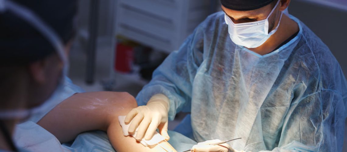 Escleroterapia com glicose Escleroterapia com glicose