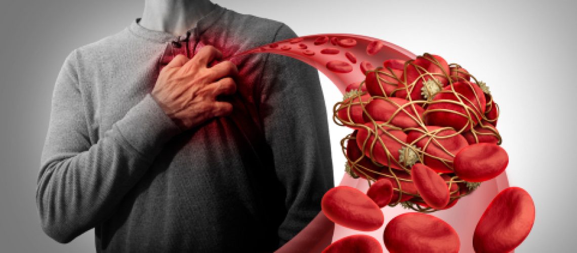 thrombosis thrombosis